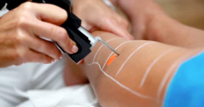 Bulundurulması yasak olan epilasyon cihazı bulunduğu ve uygulama yapıldığından bahisle işyeri ruhsatının iptali